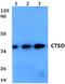 Cathepsin K antibody, A11029, Boster Biological Technology, Western Blot image 