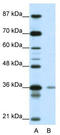 Hypoxia-inducible factor 1-alpha inhibitor antibody, TA345229, Origene, Western Blot image 