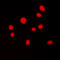 ATR Interacting Protein antibody, LS-C354219, Lifespan Biosciences, Immunofluorescence image 
