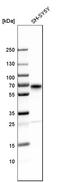 Secretogranin III antibody, HPA006880, Atlas Antibodies, Western Blot image 
