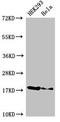 Ribonuclease H2 subunit C antibody, orb400328, Biorbyt, Western Blot image 