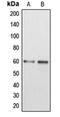 Disabled homolog 1 antibody, orb213836, Biorbyt, Western Blot image 