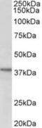 Chromosome 12 Open Reading Frame 29 antibody, NBP2-26131, Novus Biologicals, Western Blot image 