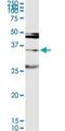 Melanoma-associated antigen 9 antibody, H00004108-D01P, Novus Biologicals, Western Blot image 