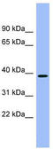 Aminocarboxymuconate Semialdehyde Decarboxylase antibody, TA337920, Origene, Western Blot image 