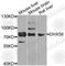 Lgp2 antibody, A8257, ABclonal Technology, Western Blot image 