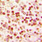 Paired box protein Pax-1 antibody, abx121967, Abbexa, Western Blot image 