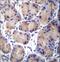 Carboxylesterase 4A antibody, LS-C203652, Lifespan Biosciences, Immunohistochemistry paraffin image 