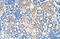 Sodium-coupled neutral amino acid transporter 1 antibody, ARP43811_T100, Aviva Systems Biology, Immunohistochemistry paraffin image 
