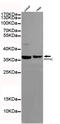 Protein Phosphatase 4 Catalytic Subunit antibody, MBS475007, MyBioSource, Western Blot image 