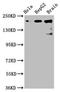 Cytoskeleton Associated Protein 5 antibody, LS-C671780, Lifespan Biosciences, Western Blot image 