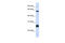 Hyaluronan-binding protein 2 antibody, 26-917, ProSci, Western Blot image 