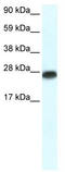 Myogenic factor 6 antibody, TA329910, Origene, Western Blot image 