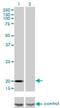 Ftl antibody, H00002512-M16, Novus Biologicals, Proximity Ligation Assay image 