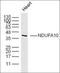 NADH:Ubiquinone Oxidoreductase Subunit A10 antibody, orb6130, Biorbyt, Western Blot image 