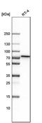 Polypeptide N-acetylgalactosaminyltransferase 1 antibody, PA5-52961, Invitrogen Antibodies, Western Blot image 