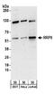 Ribosomal RNA Processing 9, U3 Small Nucleolar RNA Binding Protein antibody, A303-970A, Bethyl Labs, Western Blot image 