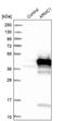 Armadillo Repeat Containing 1 antibody, PA5-55289, Invitrogen Antibodies, Western Blot image 