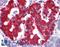 V-Set Domain Containing T Cell Activation Inhibitor 1 antibody, LS-B4055, Lifespan Biosciences, Immunohistochemistry frozen image 