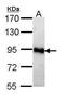 AMP deaminase 2 antibody, PA5-29518, Invitrogen Antibodies, Western Blot image 