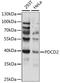 Programmed Cell Death 2 antibody, LS-C750270, Lifespan Biosciences, Western Blot image 
