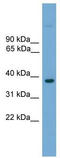 FOXE1 antibody, TA331434, Origene, Western Blot image 