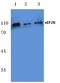 Eukaryotic Elongation Factor 2 Kinase antibody, AP06095PU-N, Origene, Western Blot image 