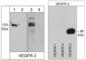 Fms Related Tyrosine Kinase 4 antibody, VP2941, ECM Biosciences, Western Blot image 