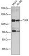 Dentin sialophosphoprotein antibody, A01740, Boster Biological Technology, Western Blot image 