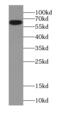 Catalase antibody, FNab01302, FineTest, Western Blot image 