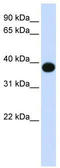 DES1 antibody, TA338219, Origene, Western Blot image 