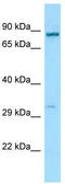 Receptor Transporter Protein 1 antibody, TA337819, Origene, Western Blot image 