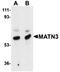 Matrilin 3 antibody, orb75188, Biorbyt, Western Blot image 