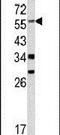 Yes Associated Protein 1 antibody, PA5-13504, Invitrogen Antibodies, Western Blot image 