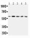 Growth Factor Receptor Bound Protein 7 antibody, PA5-79323, Invitrogen Antibodies, Western Blot image 