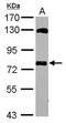 Myotubularin Related Protein 14 antibody, GTX116762, GeneTex, Western Blot image 