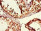 hMSH4 antibody, CSB-PA015030LA01HU, Cusabio, Immunohistochemistry paraffin image 
