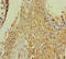 Collagen Type VI Alpha 6 Chain antibody, LS-C371226, Lifespan Biosciences, Immunohistochemistry paraffin image 