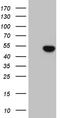 Elongator Acetyltransferase Complex Subunit 4 antibody, LS-C798667, Lifespan Biosciences, Western Blot image 