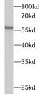 3-Oxoacid CoA-Transferase 1 antibody, FNab09880, FineTest, Western Blot image 