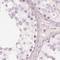 Keratin 82 antibody, NBP2-31727, Novus Biologicals, Immunohistochemistry paraffin image 