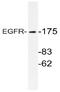 EGFR antibody, AP20754PU-N, Origene, Western Blot image 