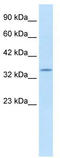 Potassium Voltage-Gated Channel Subfamily A Regulatory Beta Subunit 2 antibody, TA338756, Origene, Western Blot image 