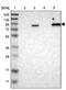 WNK Lysine Deficient Protein Kinase 2 antibody, PA5-53321, Invitrogen Antibodies, Western Blot image 