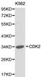 Ubiquitin carboxyl-terminal hydrolase BAP1 antibody, LS-C192634, Lifespan Biosciences, Western Blot image 