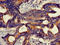 Hydroxymethylbilane Synthase antibody, CSB-PA010524LA01HU, Cusabio, Immunohistochemistry paraffin image 