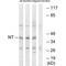 Neurotrimin antibody, A03097, Boster Biological Technology, Western Blot image 