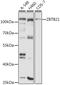 Zinc Finger And BTB Domain Containing 21 antibody, 14-630, ProSci, Western Blot image 
