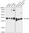 Estradiol 17-beta-dehydrogenase 8 antibody, A08741, Boster Biological Technology, Western Blot image 