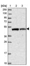 VPS37C Subunit Of ESCRT-I antibody, PA5-60335, Invitrogen Antibodies, Western Blot image 